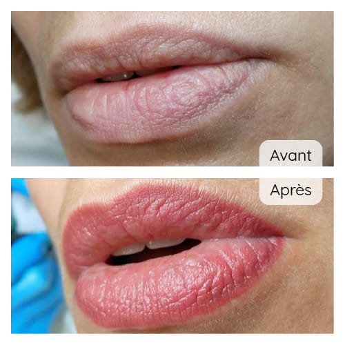 Maquillage permanent des lèvres