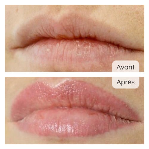 Maquillage permanent des lèvres